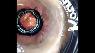 AnalAlain his asshole